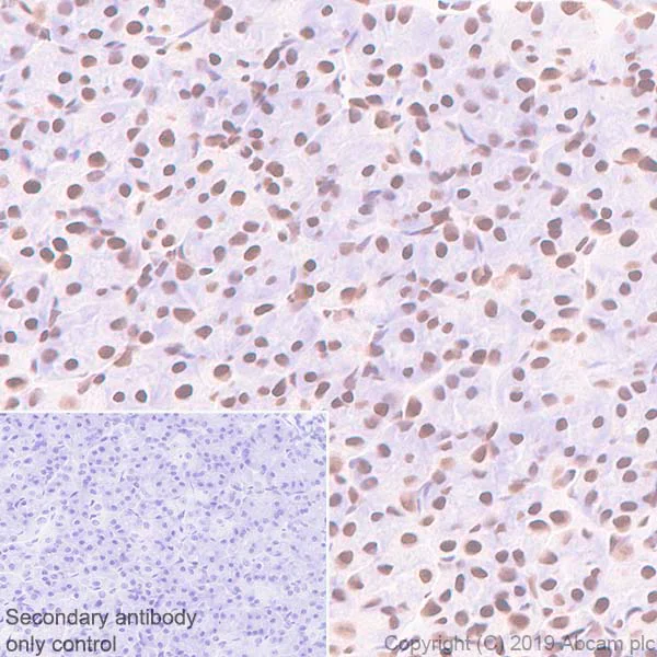 Immunohistochemistry (Formalin/PFA-fixed paraffin-embedded sections) - Anti-BRG1 antibody [EPR3912] (AB108318)