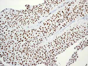 Immunohistochemistry (Formalin/PFA-fixed paraffin-embedded sections) - Anti-BRG1 antibody [EPR3912] - BSA and Azide free (ab222230), expandable thumbnail