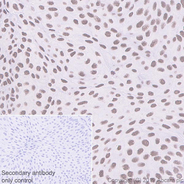 Immunohistochemistry (Formalin/PFA-fixed paraffin-embedded sections) - Anti-BRG1 antibody [EPR3912] - BSA and Azide free (AB222230), expandable thumbnail