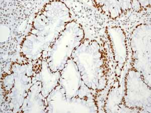Immunohistochemistry (Formalin/PFA-fixed paraffin-embedded sections) - Anti-BRG1 antibody [EPR3912] - BSA and Azide free (ab222230), expandable thumbnail