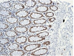 Immunohistochemistry (Formalin/PFA-fixed paraffin-embedded sections) - Anti-BRG1 antibody [EPR3912] - BSA and Azide free (ab222230), expandable thumbnail