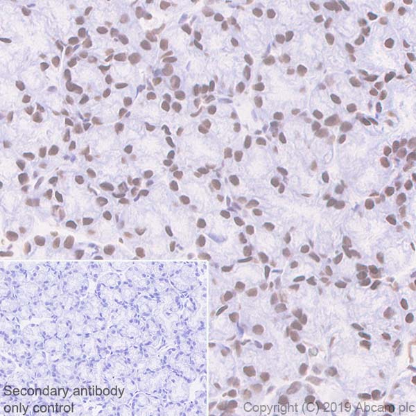Immunohistochemistry (Formalin/PFA-fixed paraffin-embedded sections) - Anti-BRG1 antibody [EPR3912] - BSA and Azide free (ab222230), expandable thumbnail