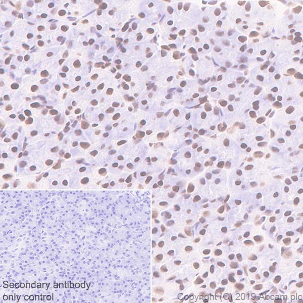 Immunohistochemistry (Formalin/PFA-fixed paraffin-embedded sections) - Anti-BRG1 antibody [EPR3912] - BSA and Azide free (ab222230), expandable thumbnail