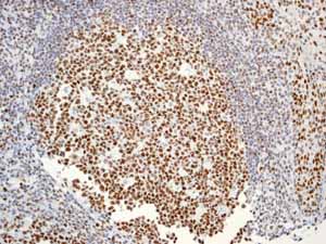 Immunohistochemistry (Formalin/PFA-fixed paraffin-embedded sections) - Anti-BRG1 antibody [EPR3912] - BSA and Azide free (ab222230), expandable thumbnail