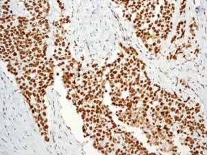 Immunohistochemistry (Formalin/PFA-fixed paraffin-embedded sections) - Anti-BRG1 antibody [EPR3912] - BSA and Azide free (ab222230), expandable thumbnail