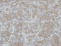 Immunohistochemistry (Formalin/PFA-fixed paraffin-embedded sections) - Anti-BRI3 antibody (AB101389)