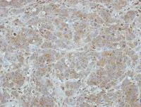 Immunohistochemistry (Formalin/PFA-fixed paraffin-embedded sections) - Anti-BRI3 antibody (AB101389)
