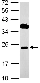 Western blot - Anti-BRI3 antibody (AB101389)