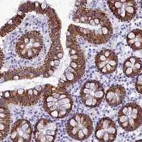 Immunohistochemistry (Formalin/PFA-fixed paraffin-embedded sections) - Anti-BRI3 antibody (AB122779)