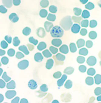 Brilliant Cresyl Blue Solution（1.5%）の製品画像