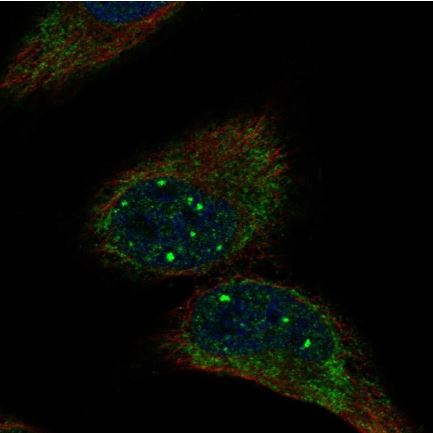 Immunocytochemistry/ Immunofluorescence - Anti-BRIP1 antibody (AB126517)