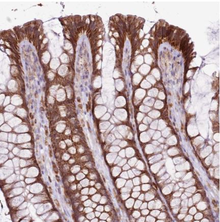 Immunohistochemistry (Formalin/PFA-fixed paraffin-embedded sections) - Anti-BRIP1 antibody (AB126517)