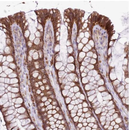 Immunohistochemistry (Formalin/PFA-fixed paraffin-embedded sections) - Anti-BRIP1 antibody (AB126517)
