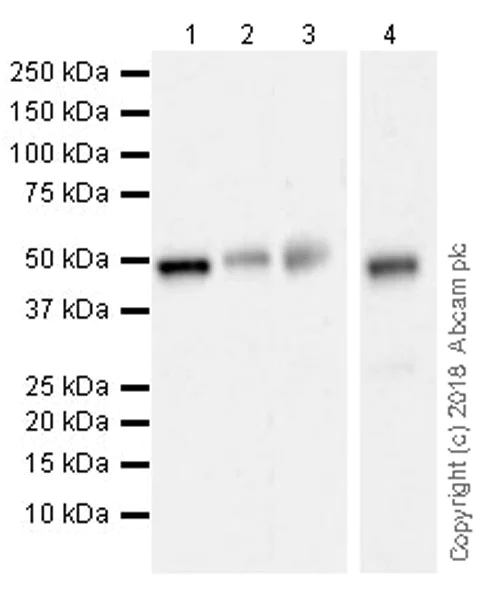 Western blot - Anti-Brk/PTK6 antibody [EPR21051-68] (AB233391)