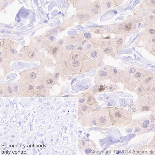 Immunohistochemistry (Formalin/PFA-fixed paraffin-embedded sections) - Anti-Brk/PTK6 antibody [EPR21051-96] (AB233392)