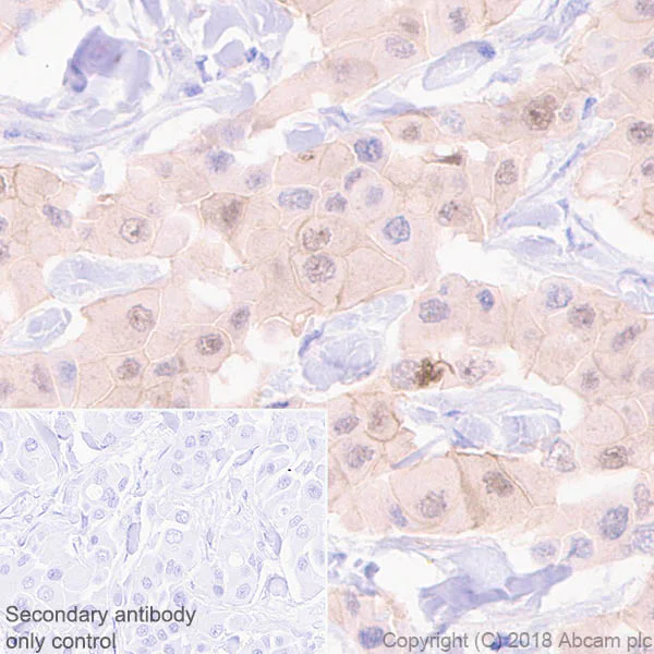 Immunohistochemistry (Formalin/PFA-fixed paraffin-embedded sections) - Anti-Brk/PTK6 antibody [EPR21051-96] (AB233392)