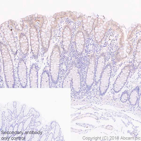 Immunohistochemistry (Formalin/PFA-fixed paraffin-embedded sections) - Anti-Brk/PTK6 antibody [EPR21051-96] - BSA and Azide free (AB234102)