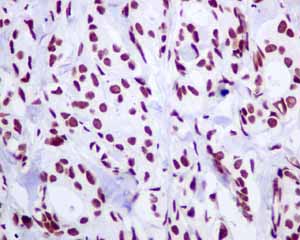 Immunohistochemistry (Formalin/PFA-fixed paraffin-embedded sections) - Anti-BRMS1 antibody [EPR7202] (AB134968)