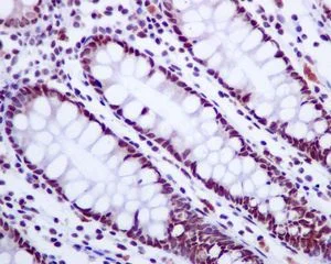 Immunohistochemistry (Formalin/PFA-fixed paraffin-embedded sections) - Anti-BRMS1 antibody [EPR7202] - BSA and Azide free (AB248760)