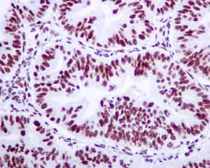 Immunohistochemistry (Formalin/PFA-fixed paraffin-embedded sections) - Anti-BRMS1 antibody [EPR7202] - BSA and Azide free (AB248760)