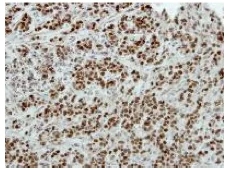 Immunohistochemistry (Formalin/PFA-fixed paraffin-embedded sections) - Anti-Brn-2 antibody (AB137469)