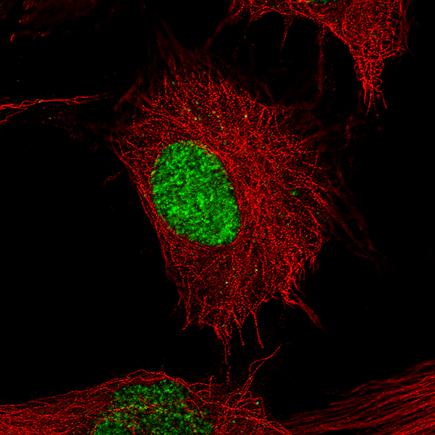 Immunocytochemistry/ Immunofluorescence - Anti-Brn-2 antibody [CL6228] (AB243045), expandable thumbnail