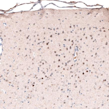 Immunohistochemistry (Formalin/PFA-fixed paraffin-embedded sections) - Anti-Brn-2 antibody [CL6228] (ab243045), expandable thumbnail