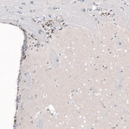 Immunohistochemistry (Formalin/PFA-fixed paraffin-embedded sections) - Anti-Brn-2 antibody [CL6228] (AB243045)