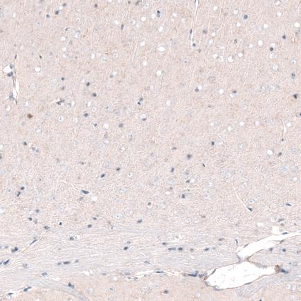 Immunohistochemistry (Formalin/PFA-fixed paraffin-embedded sections) - Anti-Brn-2 antibody [CL6228] (ab243045), expandable thumbnail