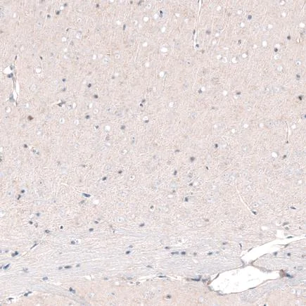 Immunohistochemistry (Formalin/PFA-fixed paraffin-embedded sections) - Anti-Brn-2 antibody [CL6228] (AB243045)