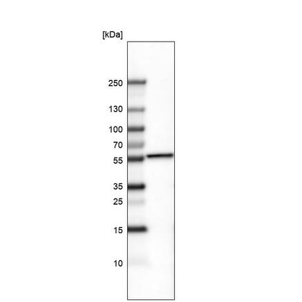 Western blot - Anti-Brn-2 antibody [CL6228] (AB243045), expandable thumbnail