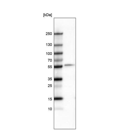 Western blot - Anti-Brn-2 antibody [CL6228] (AB243045), expandable thumbnail
