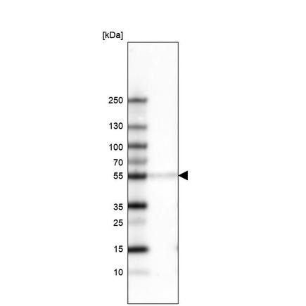 Western blot - Anti-Brn-2 antibody [CL6228] (ab243045), expandable thumbnail