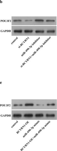 Western blot - Anti-Brn-2 antibody [CL6228] (ab243045), expandable thumbnail