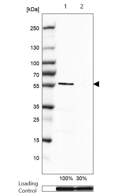 Western blot - Anti-Brn-2 antibody [CL6228] (AB243045), expandable thumbnail