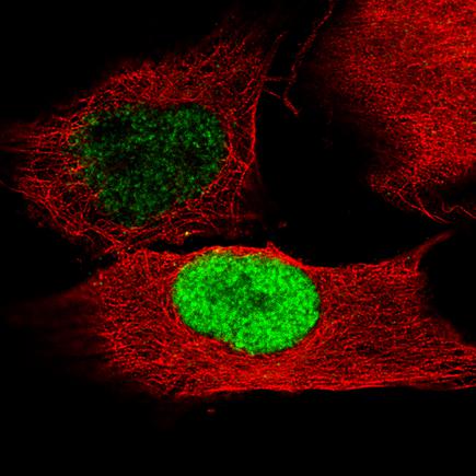 Immunocytochemistry/ Immunofluorescence - Anti-Brn-2 antibody [CL6232] (ab243026), expandable thumbnail