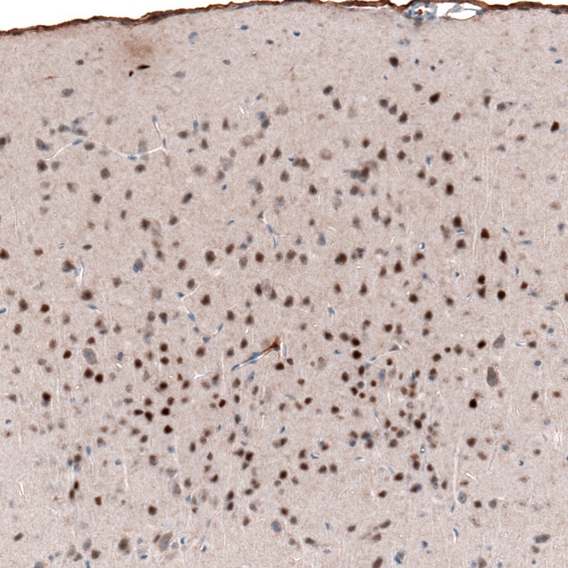 Immunohistochemistry (Formalin/PFA-fixed paraffin-embedded sections) - Anti-Brn-2 antibody [CL6232] (AB243026), expandable thumbnail