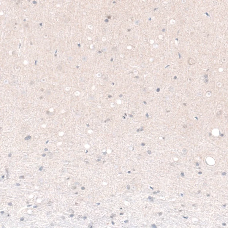 Immunohistochemistry (Formalin/PFA-fixed paraffin-embedded sections) - Anti-Brn-2 antibody [CL6232] (AB243026)