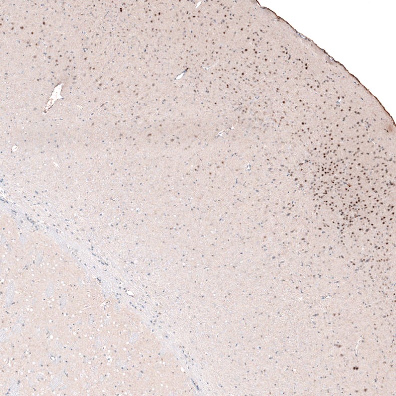 Immunohistochemistry (Formalin/PFA-fixed paraffin-embedded sections) - Anti-Brn-2 antibody [CL6232] (AB243026), expandable thumbnail