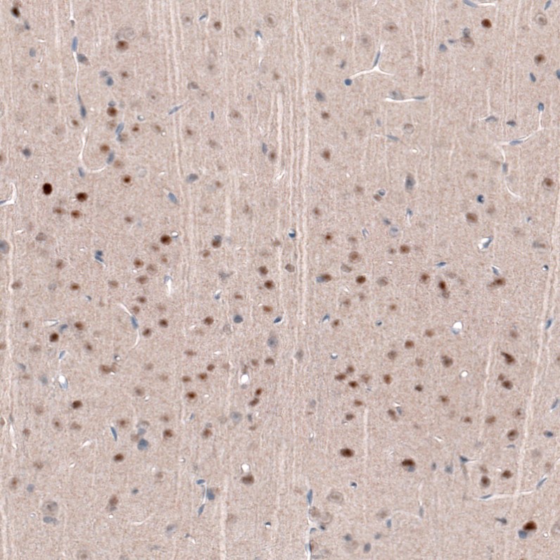 Immunohistochemistry (Formalin/PFA-fixed paraffin-embedded sections) - Anti-Brn-2 antibody [CL6232] (AB243026), expandable thumbnail