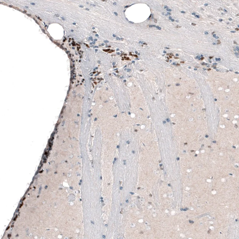 Immunohistochemistry (Formalin/PFA-fixed paraffin-embedded sections) - Anti-Brn-2 antibody [CL6232] (AB243026)