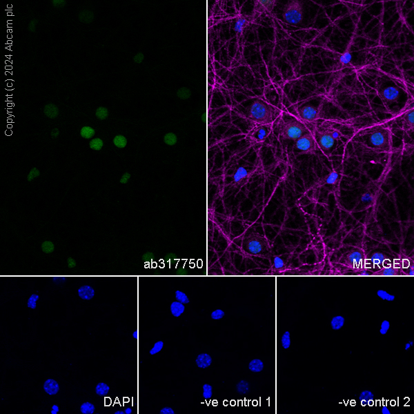 Immunocytochemistry/ Immunofluorescence - Anti-Brn-2 antibody [EPR29141-41] (AB317750), expandable thumbnail