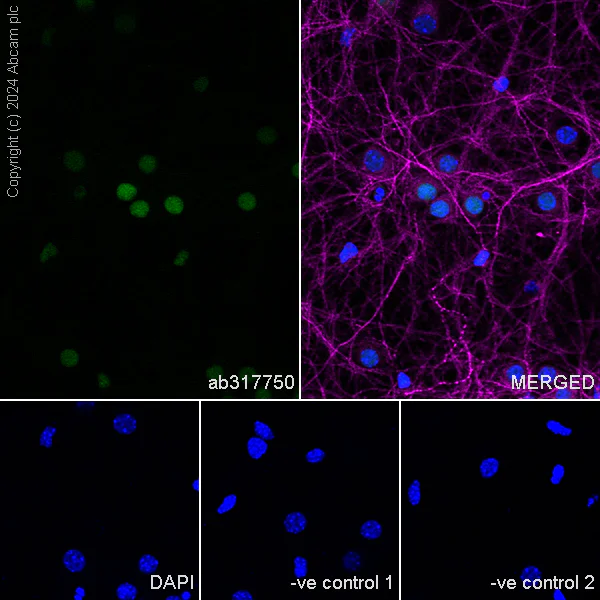 Immunocytochemistry/ Immunofluorescence - Anti-Brn-2 antibody [EPR29141-41] (AB317750)