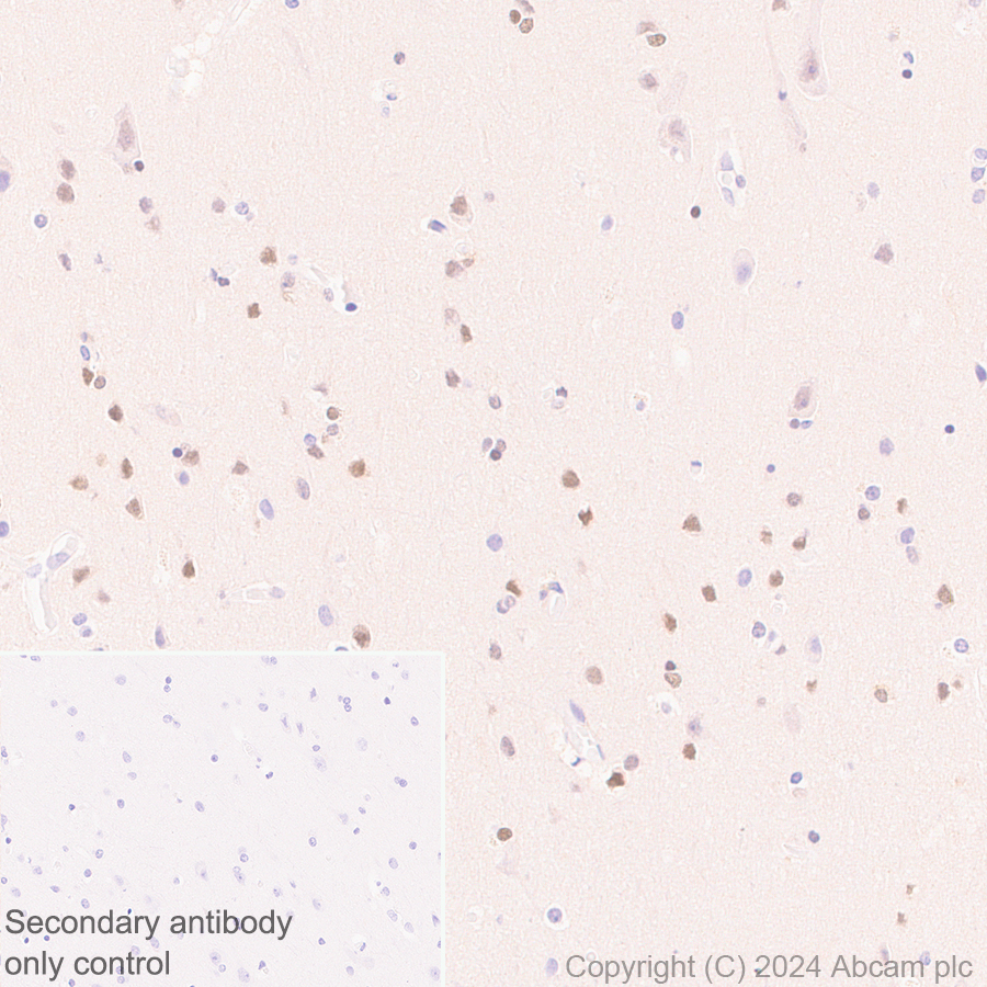 Immunohistochemistry (Formalin/PFA-fixed paraffin-embedded sections) - Anti-Brn-2 antibody [EPR29141-41] (ab317750), expandable thumbnail