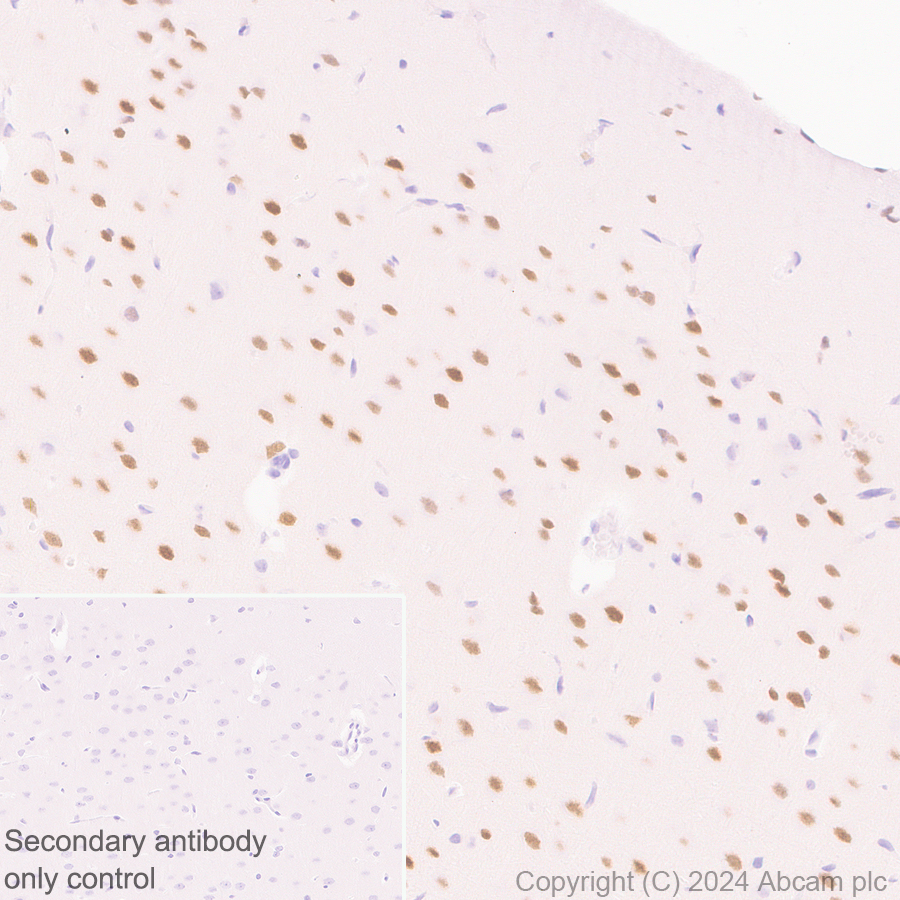 Immunohistochemistry (Formalin/PFA-fixed paraffin-embedded sections) - Anti-Brn-2 antibody [EPR29141-41] (ab317750), expandable thumbnail