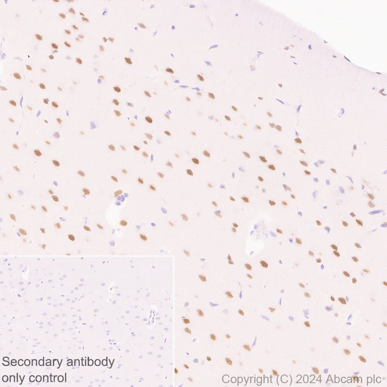Immunohistochemistry (Formalin/PFA-fixed paraffin-embedded sections) - Anti-Brn-2 antibody [EPR29141-41] (AB317750)