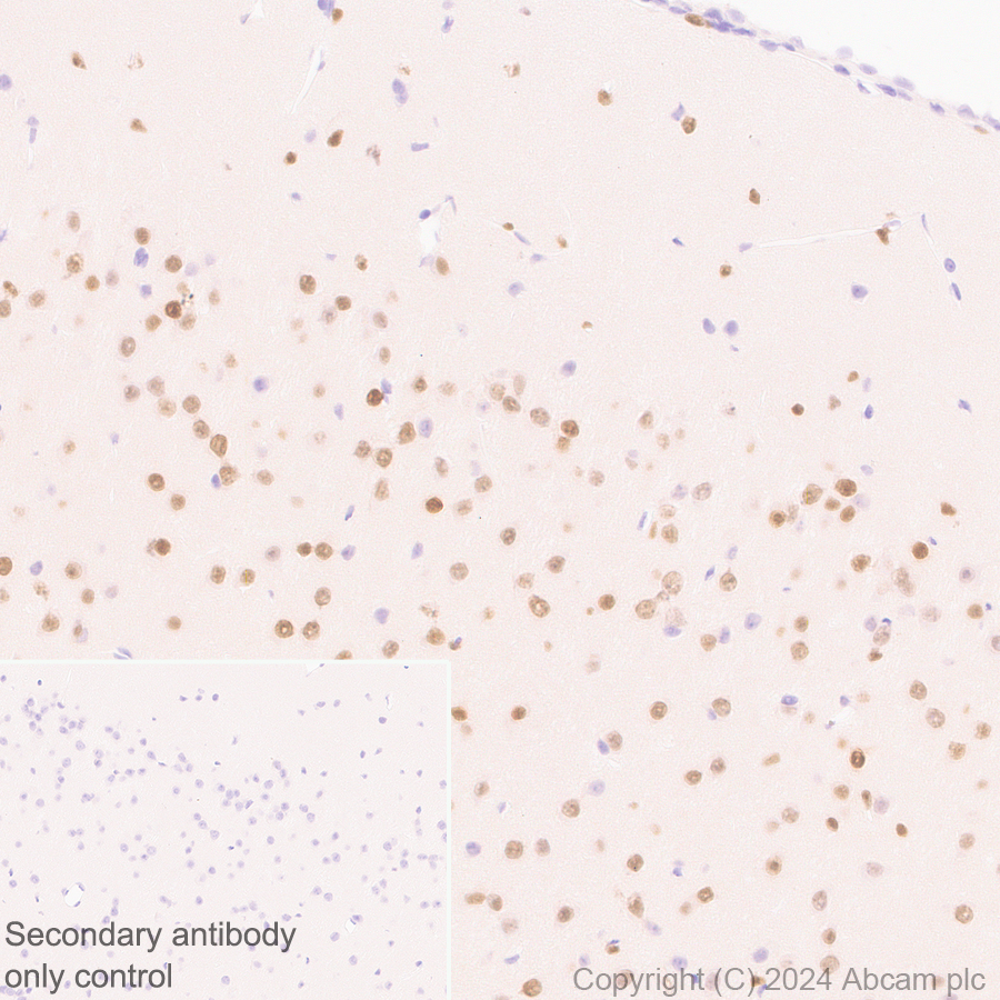 Immunohistochemistry (Formalin/PFA-fixed paraffin-embedded sections) - Anti-Brn-2 antibody [EPR29141-41] - BSA and Azide free (AB317751), expandable thumbnail
