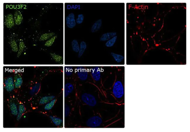 Immunocytochemistry/ Immunofluorescence - Anti-Brn-2 antibody [RP23040248] (AB308102)
