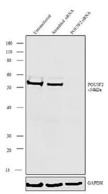 Western blot - Anti-Brn-2 antibody [RP23040248] (AB308102)