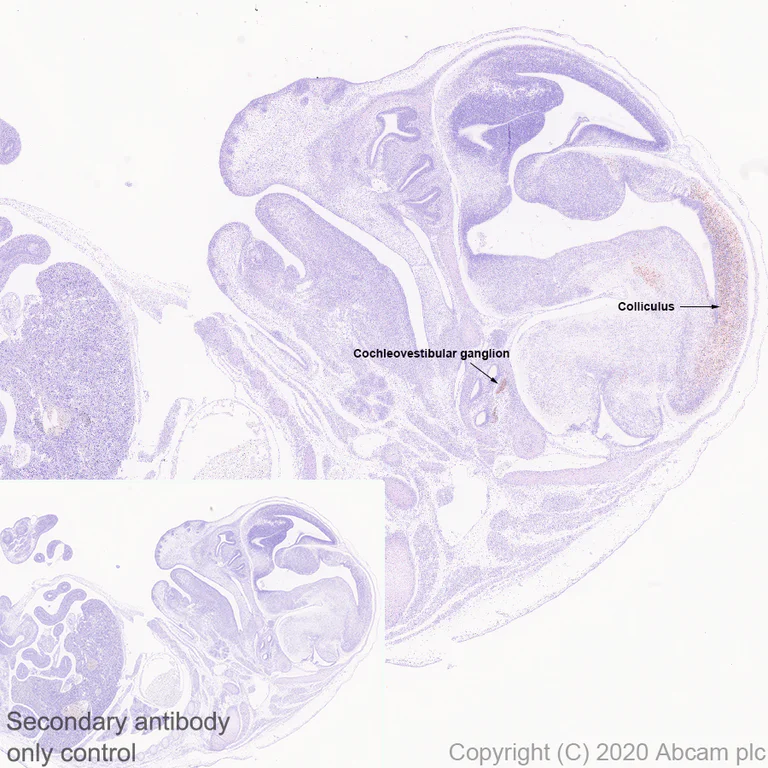 Immunohistochemistry (Formalin/PFA-fixed paraffin-embedded sections) - Anti-BRN3A antibody [EPR23257-285] - BSA and Azide free (AB273099)